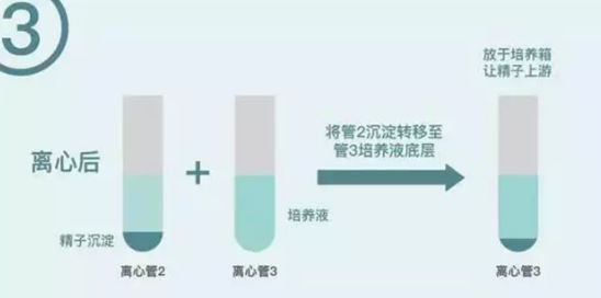 艾滋病洗精试管婴儿多少钱